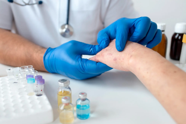 Anaphylaxis
